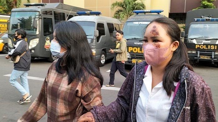 Wanita Korban Penabrakan Melapor Ke Polres Jakarta Selatan